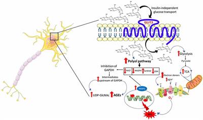 vía de diabetes sorbitol